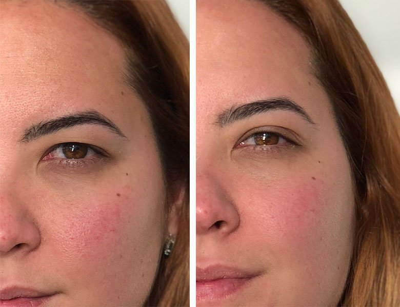 antes e depois do primer fluido